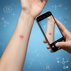 Imagen Dermatología (enviar foto)